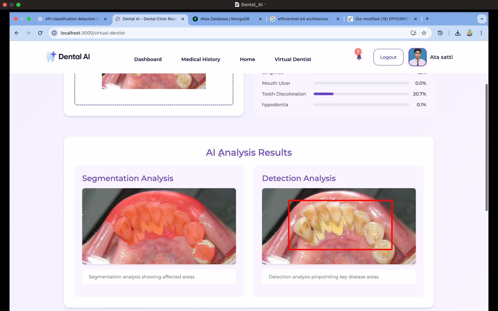 Dental AI