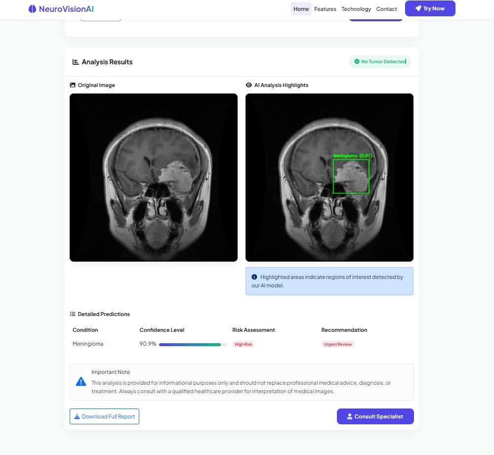 NeuroVision AI